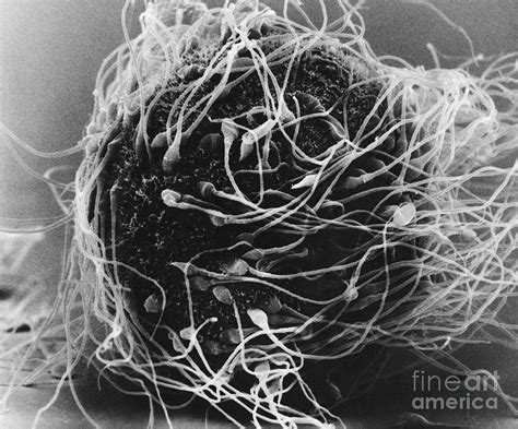 the egg sem company|SEM News & Insights .